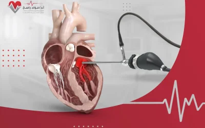 عملية تغيير الصمام الميترالي بالمنظار 