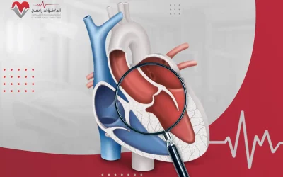 تقنية أوزاكي لاستبدال الصمام الأورطي
