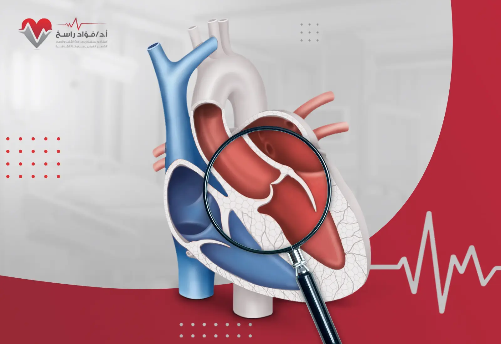 تقنية أوزاكي لاستبدال الصمام الأورطي