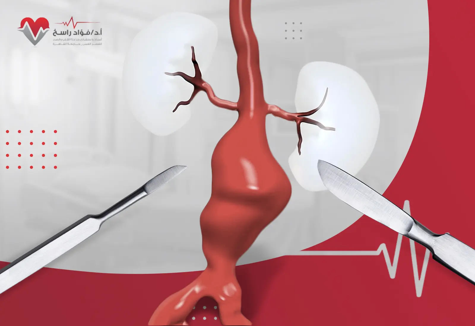علاج تمدد الشريان الأورطي البطني