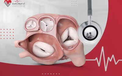 هل يُمكن علاج صمام القلب دون جراحة؟ 