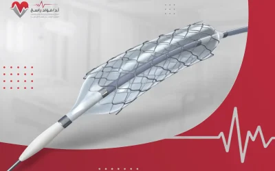 كل ما تود معرفته عن أنواع القسطرة القلبية
