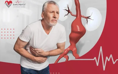 تمدد الشريان الأورطي