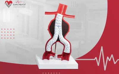 سبل علاج ضيق الشريان الأورطي
