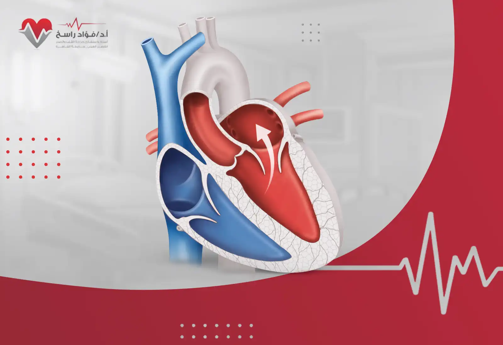 ارتجاع الصمام الميترالي
