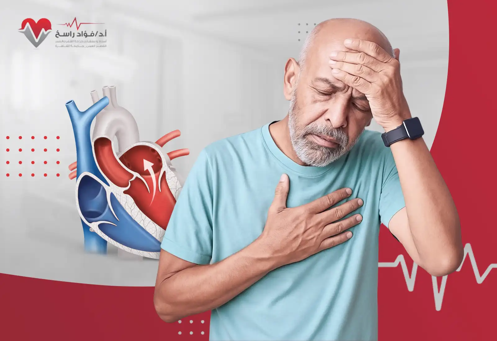 أعراض ارتخاء الصمام الميترالي