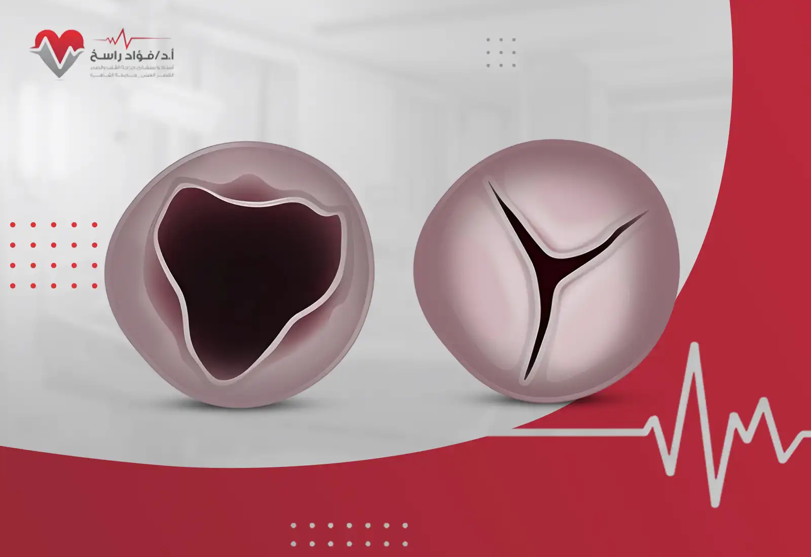 درجات ارتجاع الصمام الأورطي