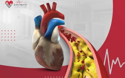 كيف تعالج شرايين القلب المسدودة؟
