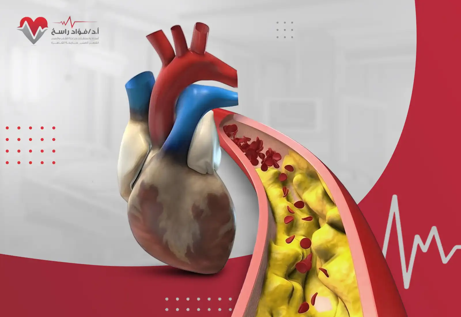 شرايين القلب المسدودة