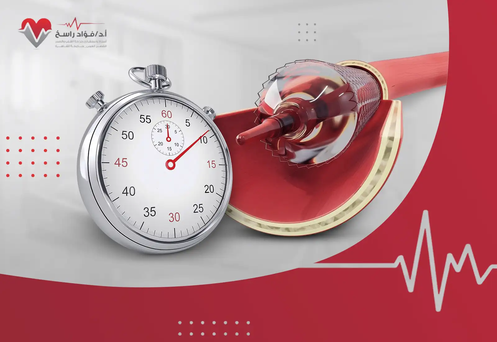 كم تستغرق عملية قسطرة القلب