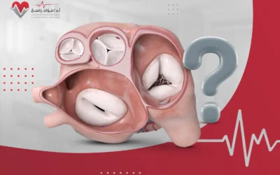 ما هي صمامات القلب وكيف تُحافظ عليها؟