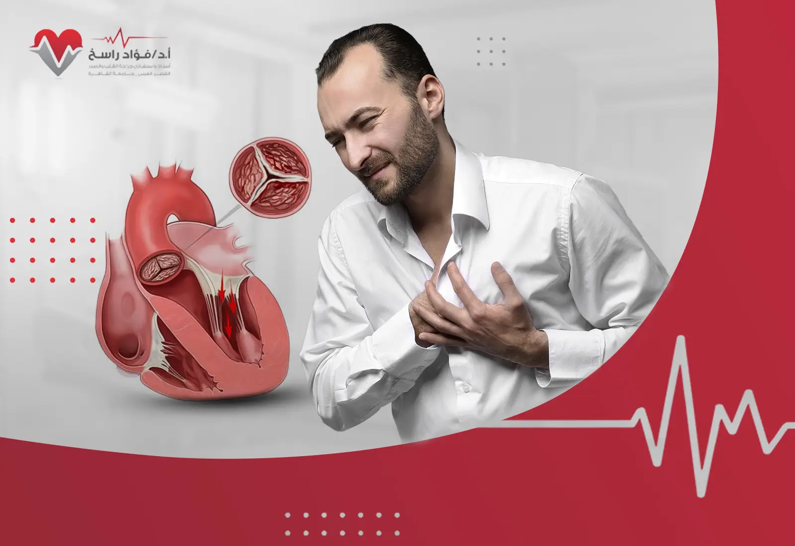 ضيق الصمام الأورطي