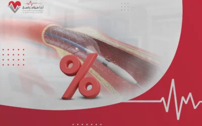 كم نسبة نجاح عملية قسطرة القلب؟ وما العوامل المؤثرة فيها؟