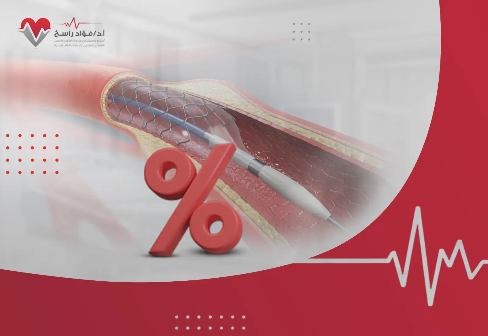 كم نسبة نجاح عملية قسطرة القلب