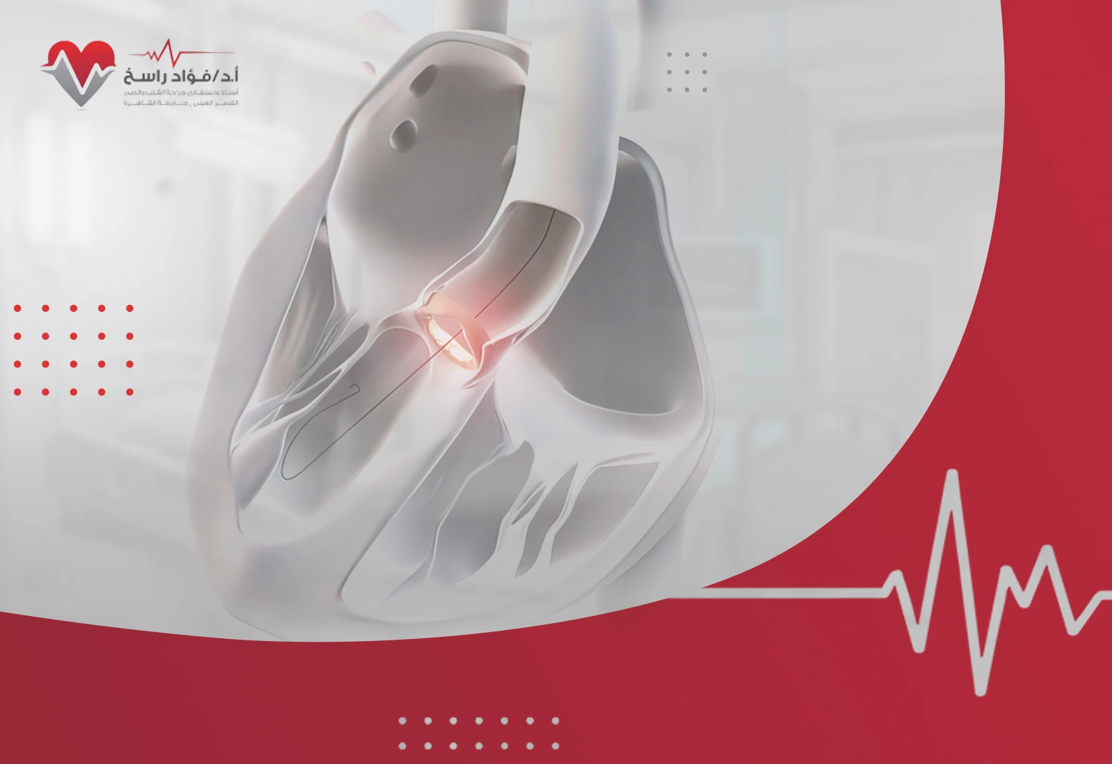 عملية توسيع صمام القلب عملية توسيع صمام القلب