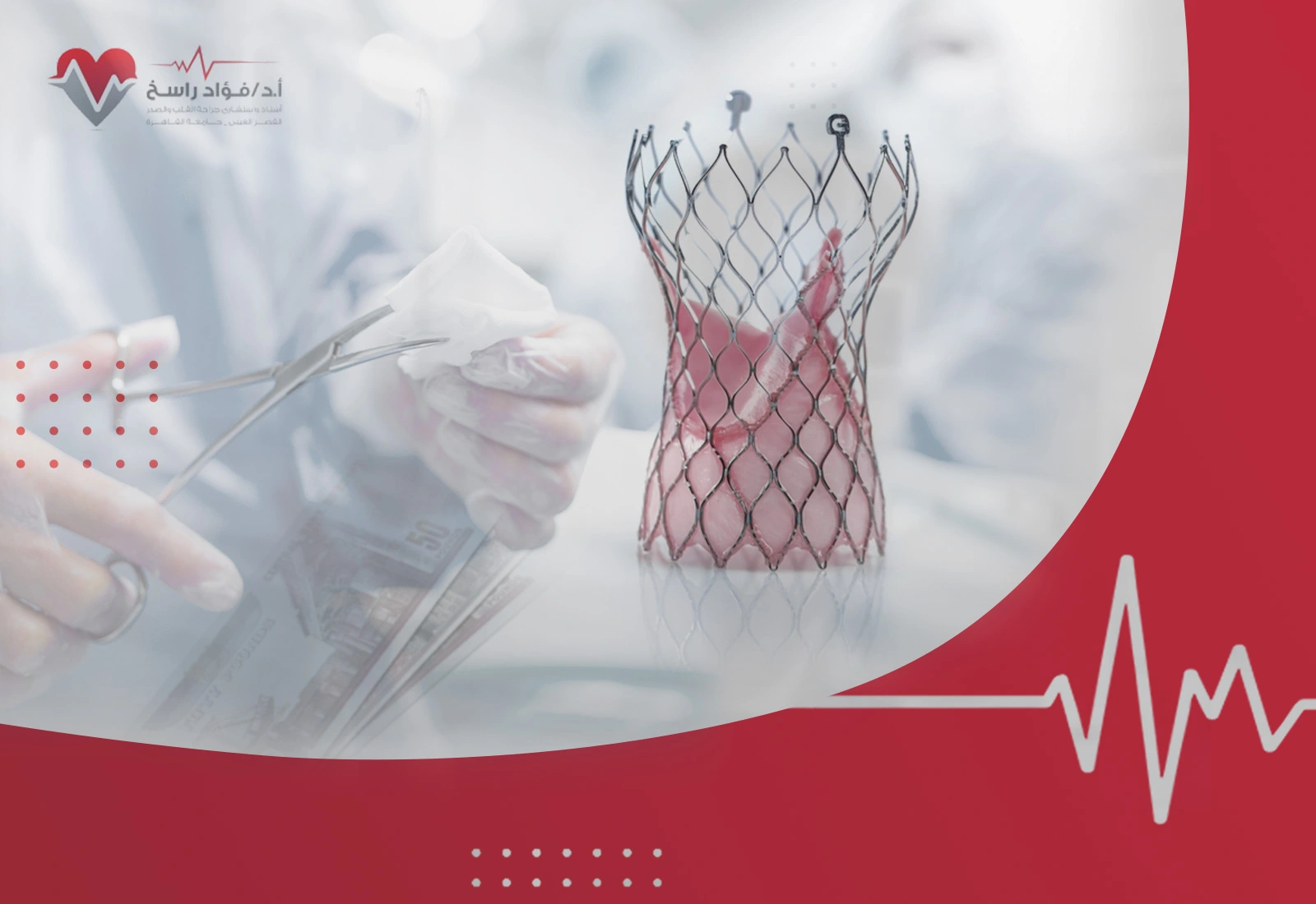 تكلفة عملية تغيير الصمام الأورطي تكلفة عملية تغيير الصمام الأورطي