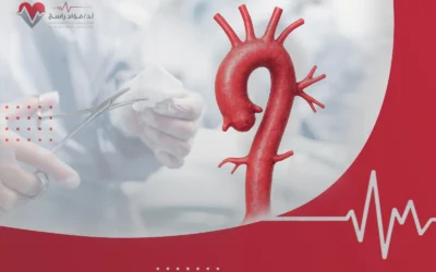 عملية الشريان الأورطي| إجراء هام للحفاظ على الحياة