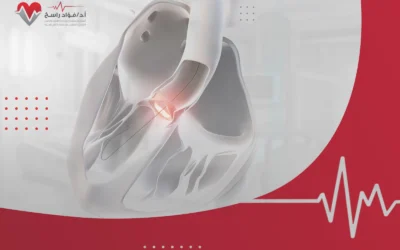 عملية توسيع صمام القلب: المضاعفات ونسب النجاح