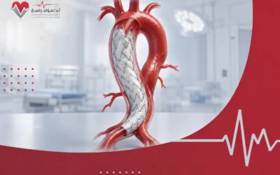 دعامة الشريان الاورطي