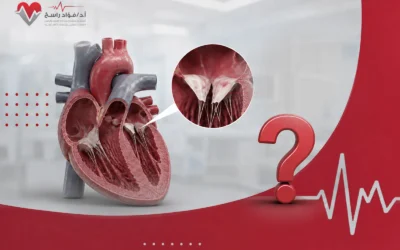 هل ارتخاء الصمام الميترالي يسبب الموت؟ تعرف إلى الحقيقة!